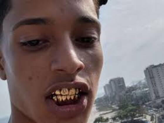 Visão do Corre dentadura.jpeg